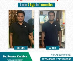 Dr.-Reema-Kashiva-7-kgs-weight-loss-in-1-months-Patients-Testimonial-Weight-Loss-Success-Stories-768x768-1